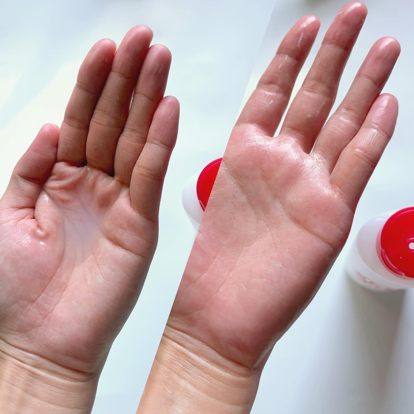 薬用化粧水/スキンライフ/化粧水を使ったクチコミ（3枚目）