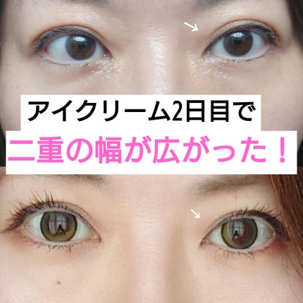 NMNプラスリフトアイクリーム/CHARDE/アイケア・アイクリームを使ったクチコミ(1枚目)