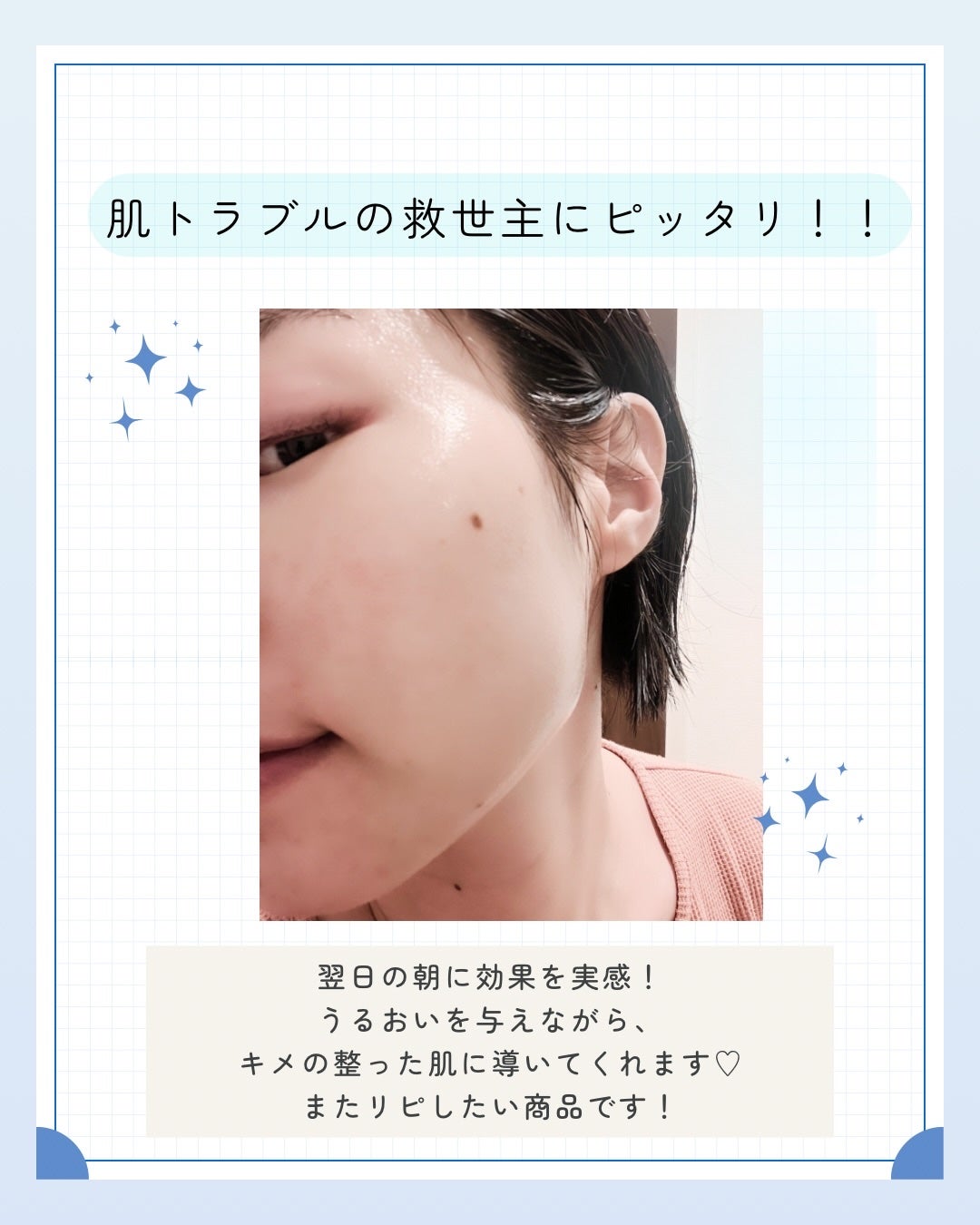 トラブルパッチマスク/EIOM/その他スキンケアを使ったクチコミ(7枚目)