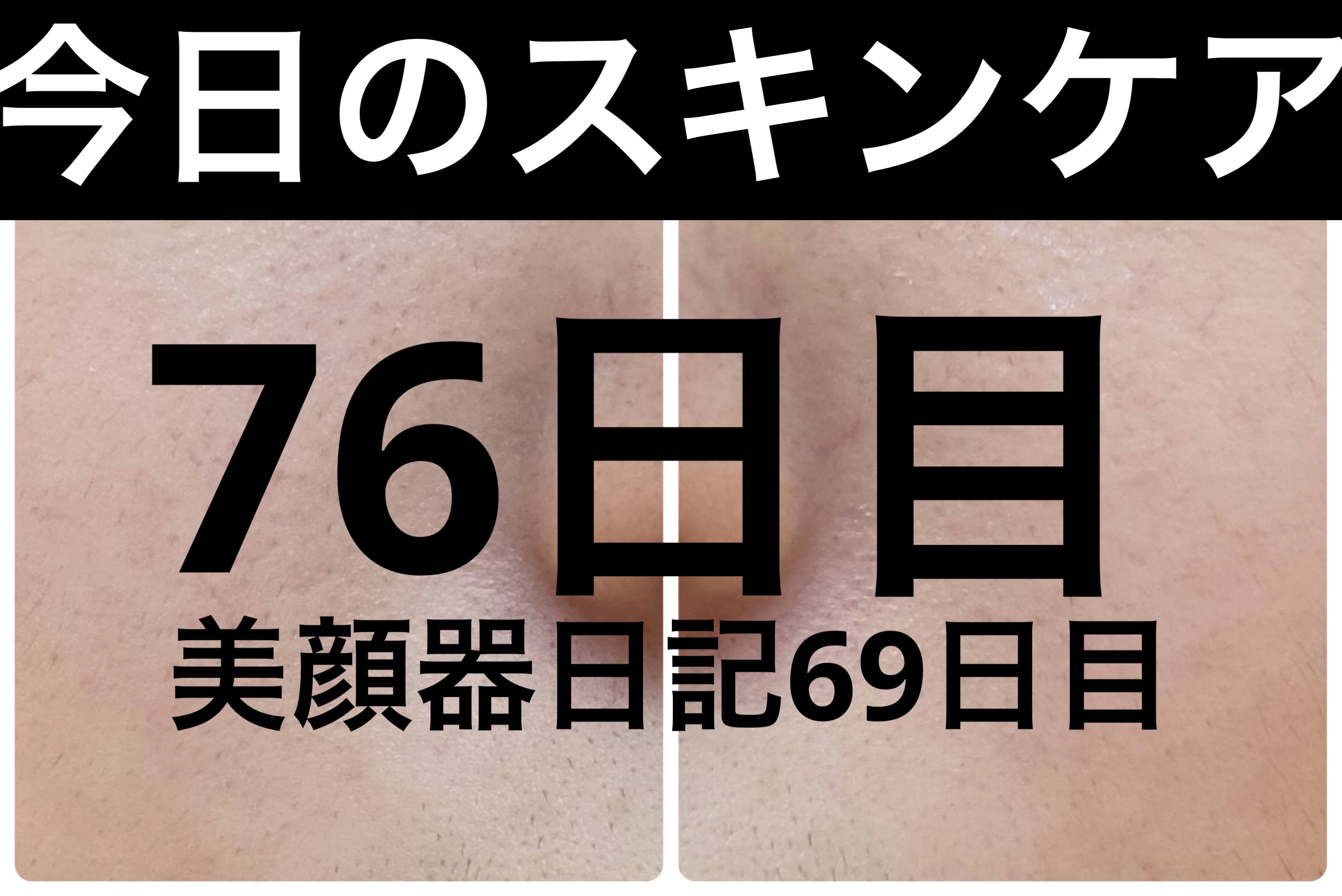 モーニングジェルウォッシュ/ビトレスキン/その他洗顔料を使ったクチコミ（1枚目）
