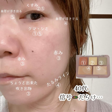 コンシールブレンダーパレット/LUNA/パレットコンシーラーを使ったクチコミ(4枚目)