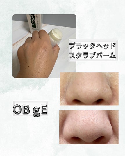 ブラックヘッドバームスクラブ/オブジェ/フェイスバームを使ったクチコミ(2枚目)