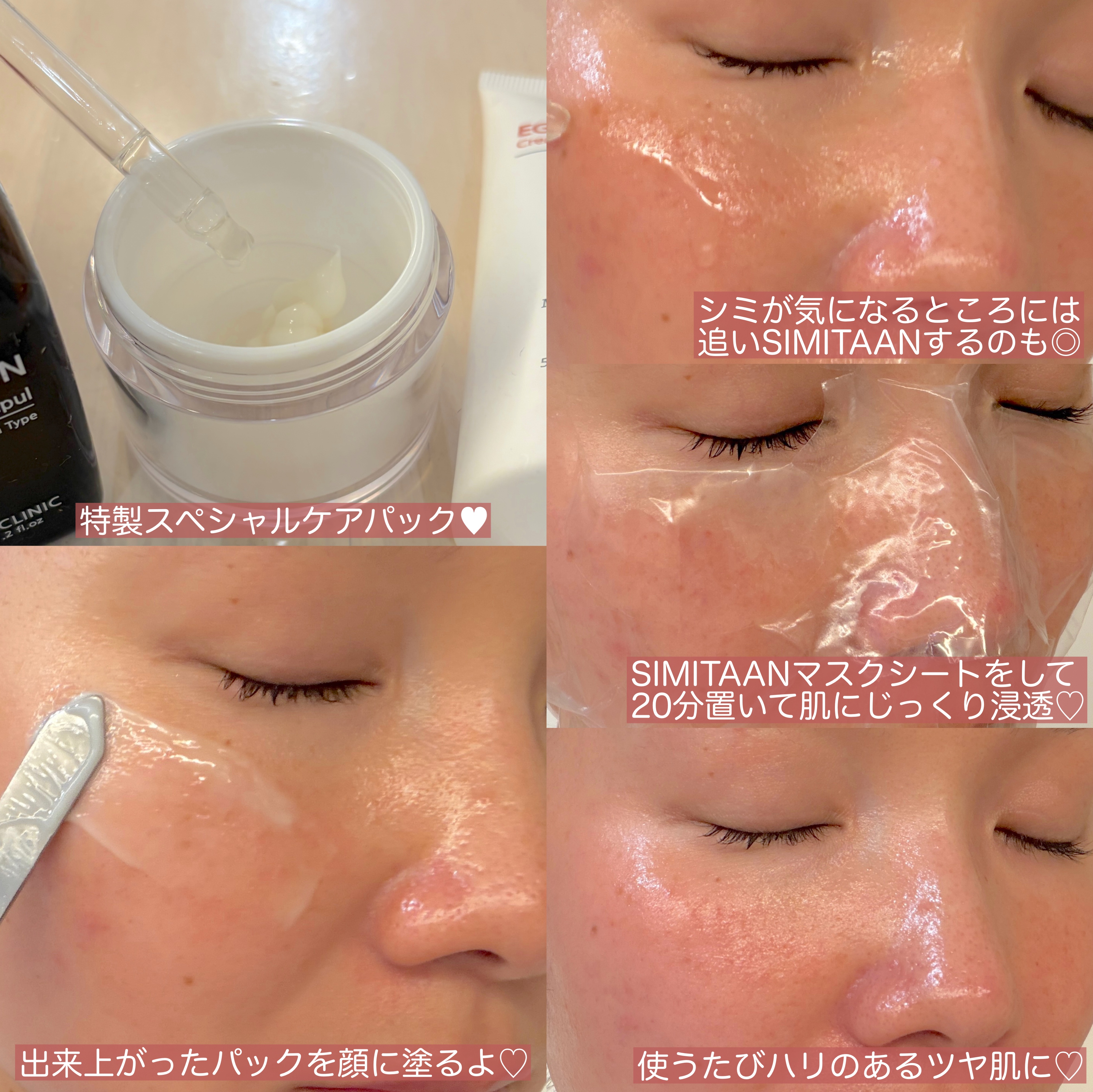 EGFクリーム/Mitam Clinic/フェイスクリームを使ったクチコミ（3枚目）