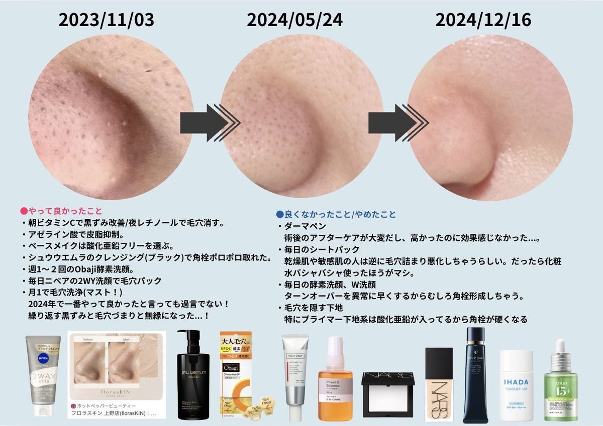 白川桃乃 on LIPS 「【黒ずみ毛穴】美容は積立投資のようなもので、若いうちからコツコ..」(2枚目)