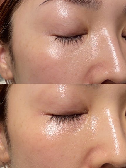 super a-shot complex mist/SallyZen/その他スキンケアを使ったクチコミ(4枚目)