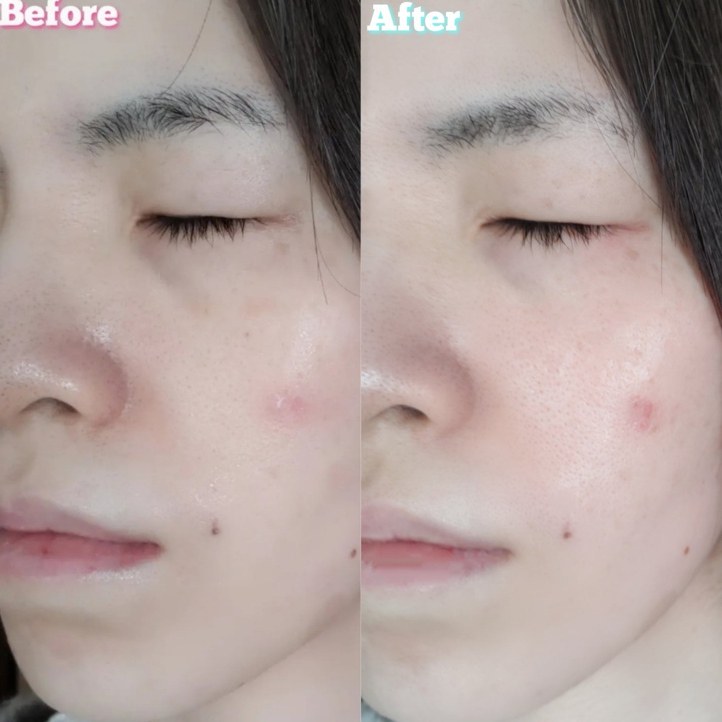 スーパーシカ B5/VITALBEAUTIE/美容サプリメントを使ったクチコミ(7枚目)