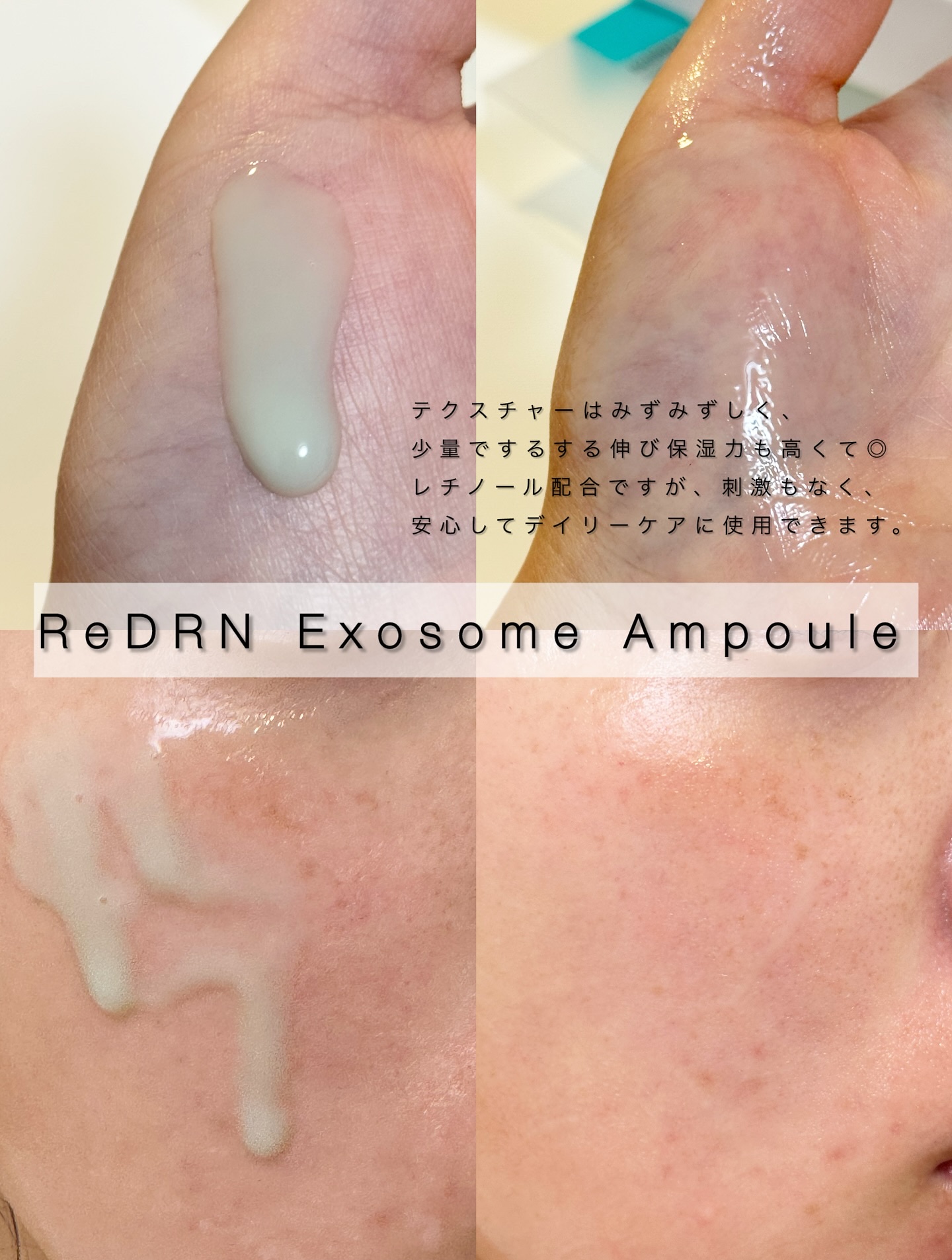 ReDRNエクソソームアンプル/Dr.nineteen/美容液を使ったクチコミ（3枚目）