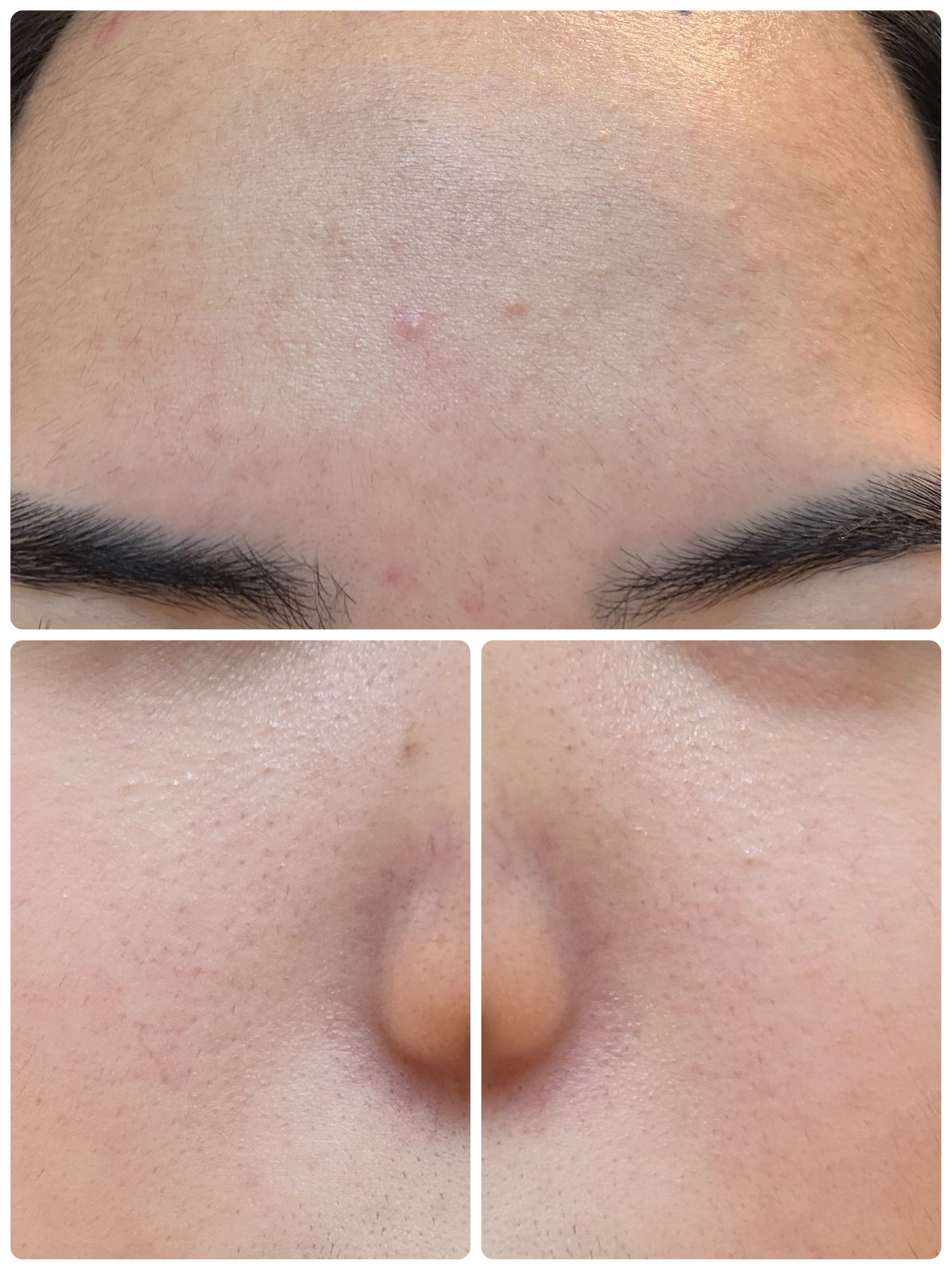 モーニングジェルウォッシュ/ビトレスキン/その他洗顔料を使ったクチコミ（3枚目）