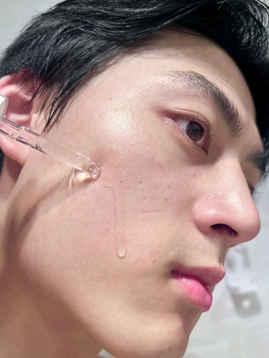 アネトス アクネケア トリートメント セラム/Anetos/美容液を使ったクチコミ（2枚目）