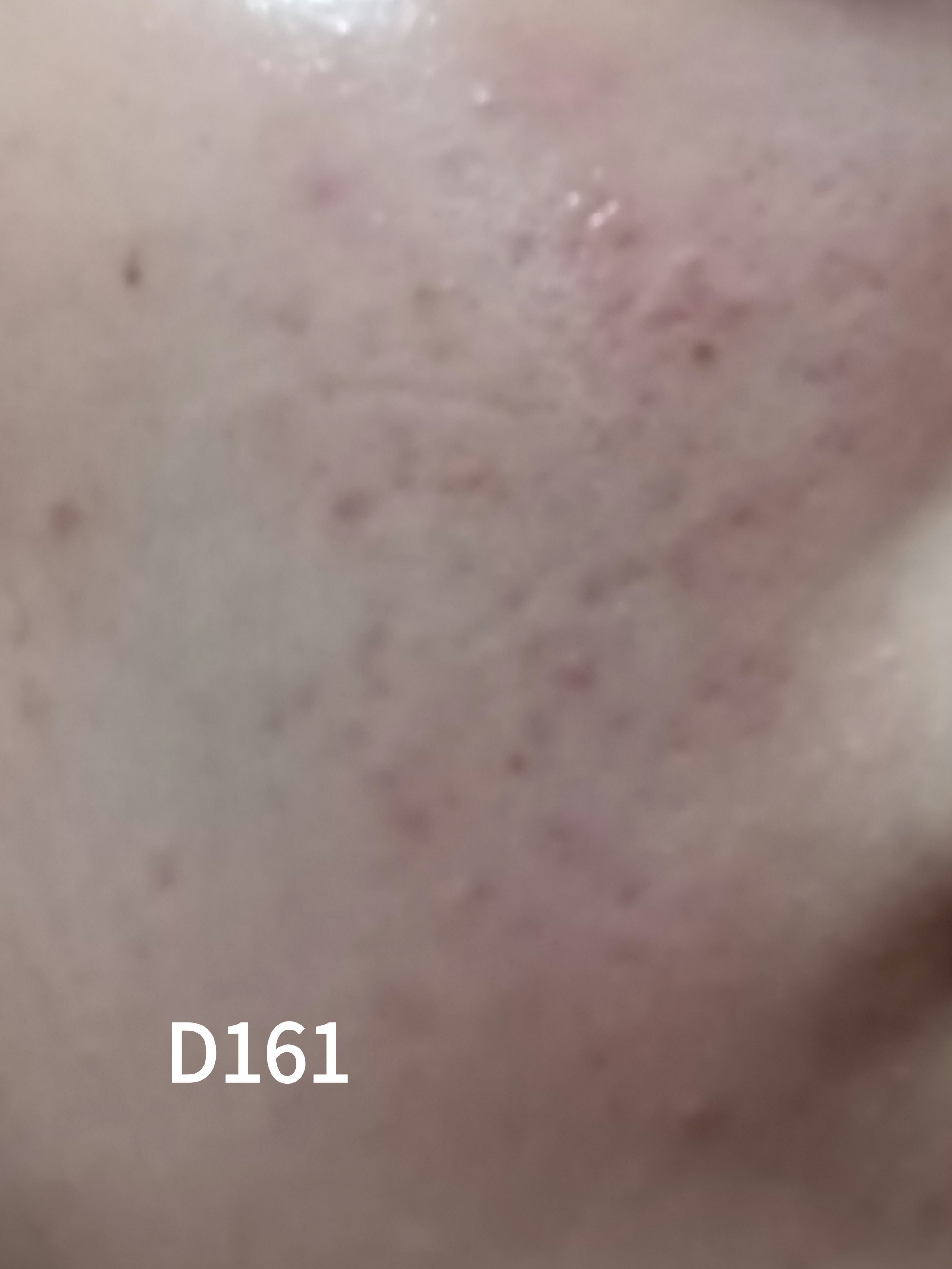 アゼライン酸16BBスージングセラム アゼライン酸16BBカーミングセラム 30ml/MEDICUBE/美容液を使ったクチコミ（1枚目）