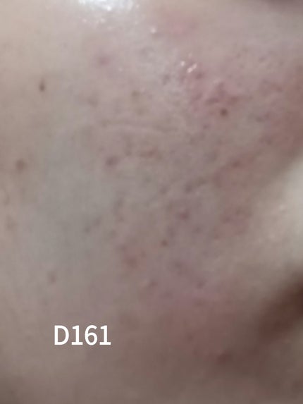 アゼライン酸16BBスージングセラム アゼライン酸16BBカーミングセラム 30ml/MEDICUBE/美容液の画像