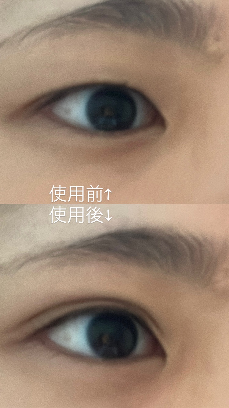 オリシキ アイリッドスキンフィルム EX/D-UP/二重まぶた用アイテムを使ったクチコミ（3枚目）