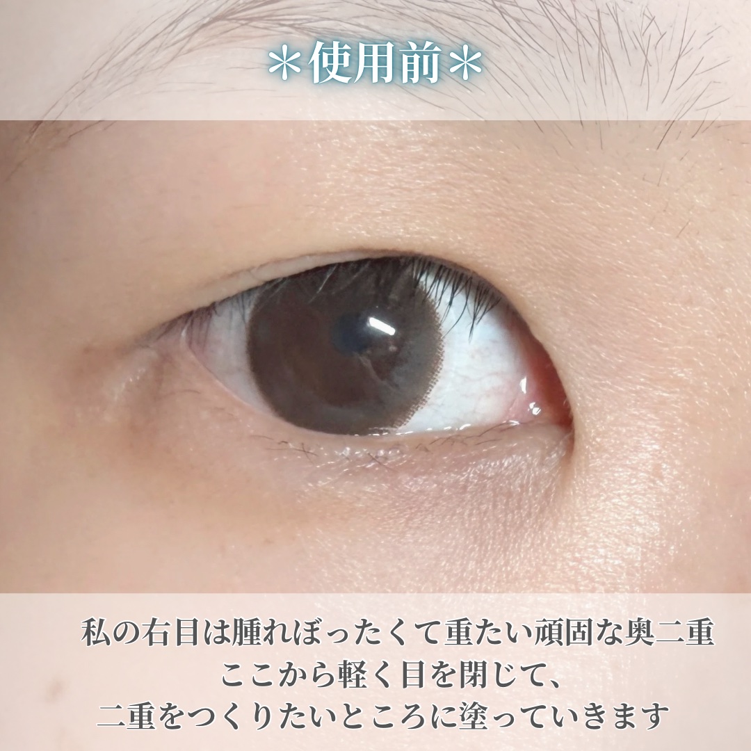オリシキ アイリッドスキンフィルム EX/D-UP/二重まぶた用アイテムを使ったクチコミ（3枚目）