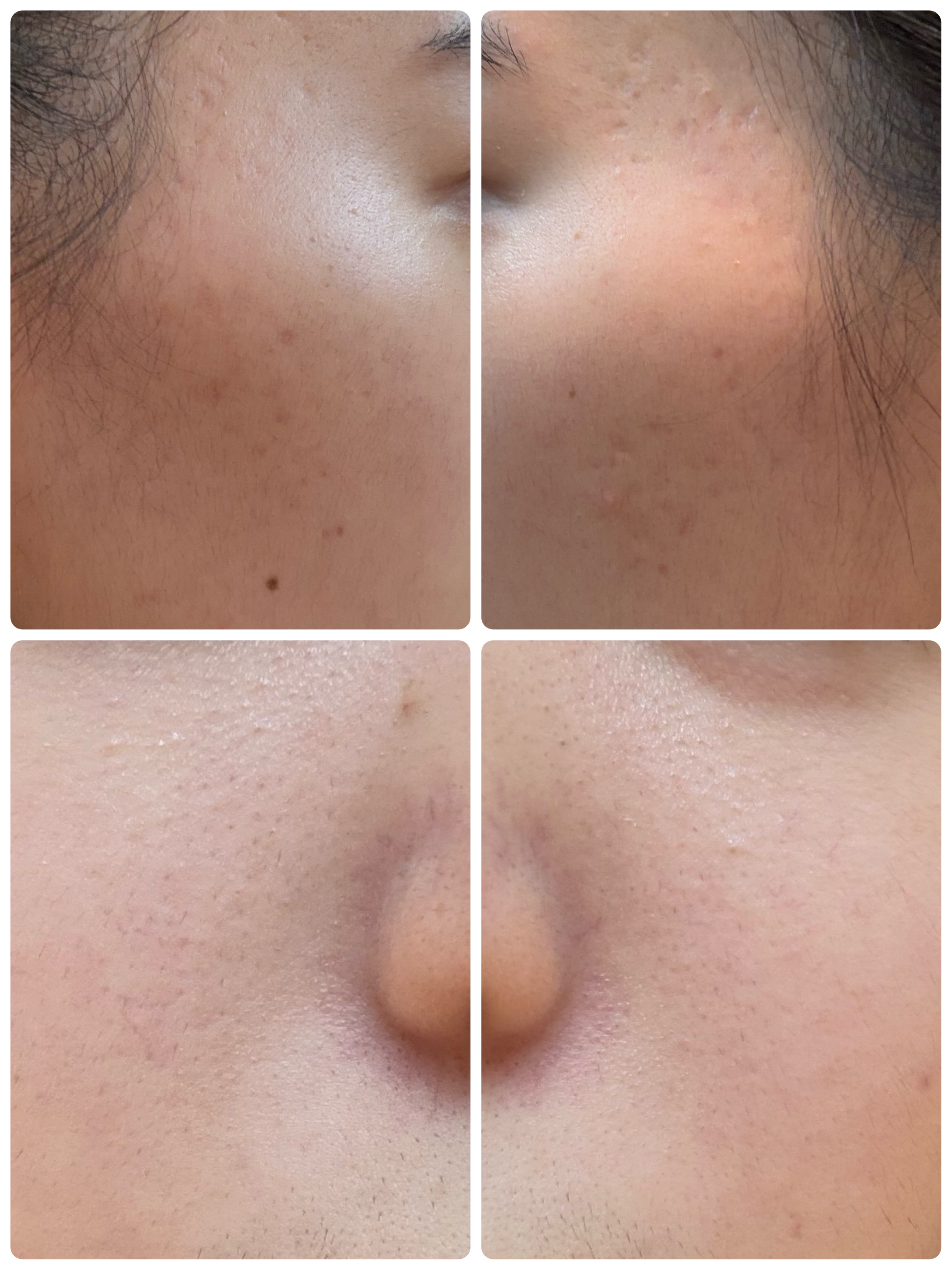 モーニングジェルウォッシュ/ビトレスキン/その他洗顔料を使ったクチコミ（2枚目）