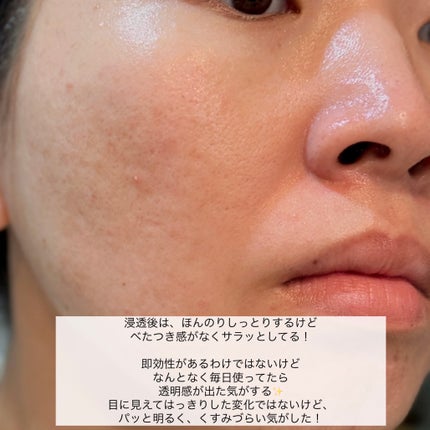 ホワイトロジスト ネオジェネシス ブライトニング コンセントレイト/DECORTÉ/美容液を使ったクチコミ(5枚目)