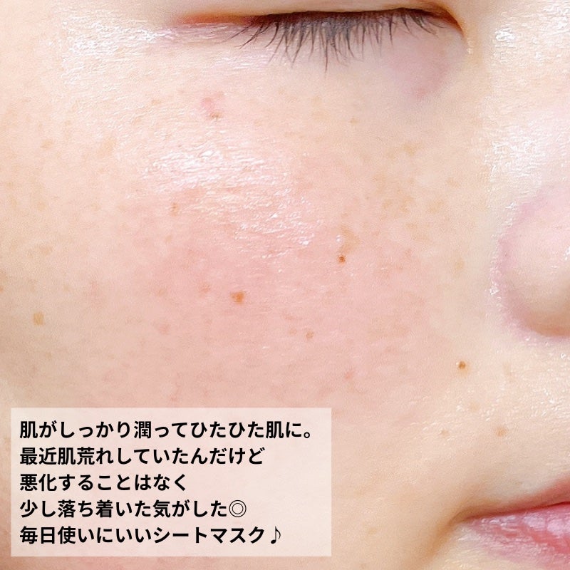 ルルルンプレシャス GREEN(Glow Up)/ルルルン/シートマスク・パックを使ったクチコミ(5枚目)