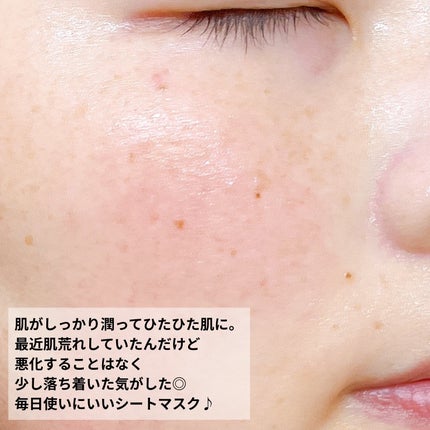 ルルルンプレシャス GREEN(Glow Up)/ルルルン/シートマスク・パックを使ったクチコミ(5枚目)