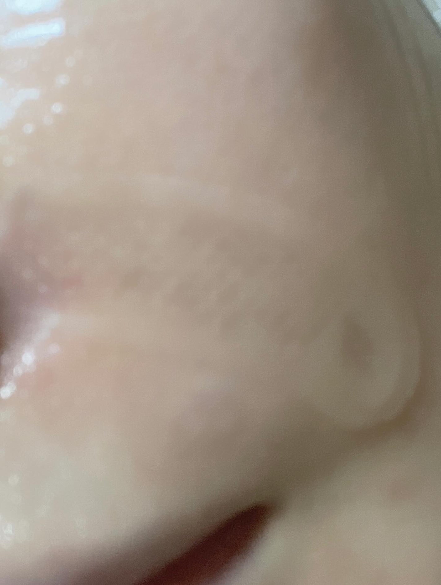 レチアールエヌ スリムパッチ/ACROPASS/シートマスク・パックを使ったクチコミ(5枚目)