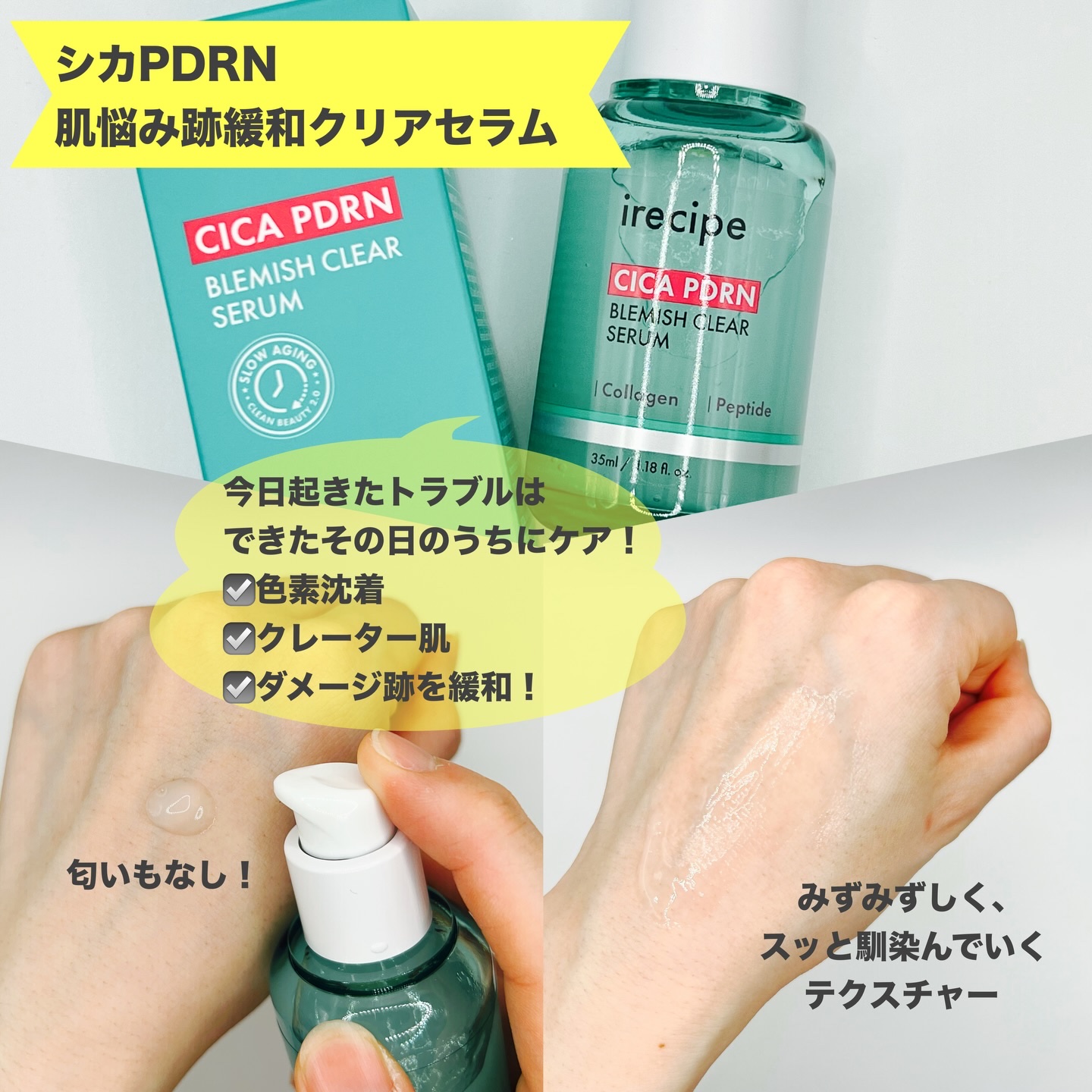 シカ PDRN 跡 クリアー トナーパッド/irecipe/トナーパッドを使ったクチコミ（3枚目）