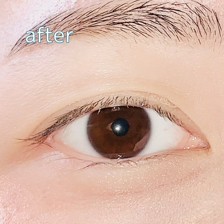 オリシキ アイリッドスキンフィルム EX/D-UP/二重まぶた用アイテムを使ったクチコミ（3枚目）