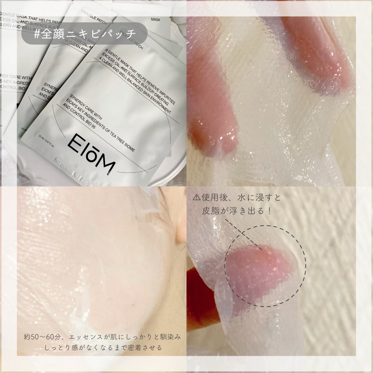 トラブルパッチマスク/EIOM/その他スキンケアを使ったクチコミ（2枚目）