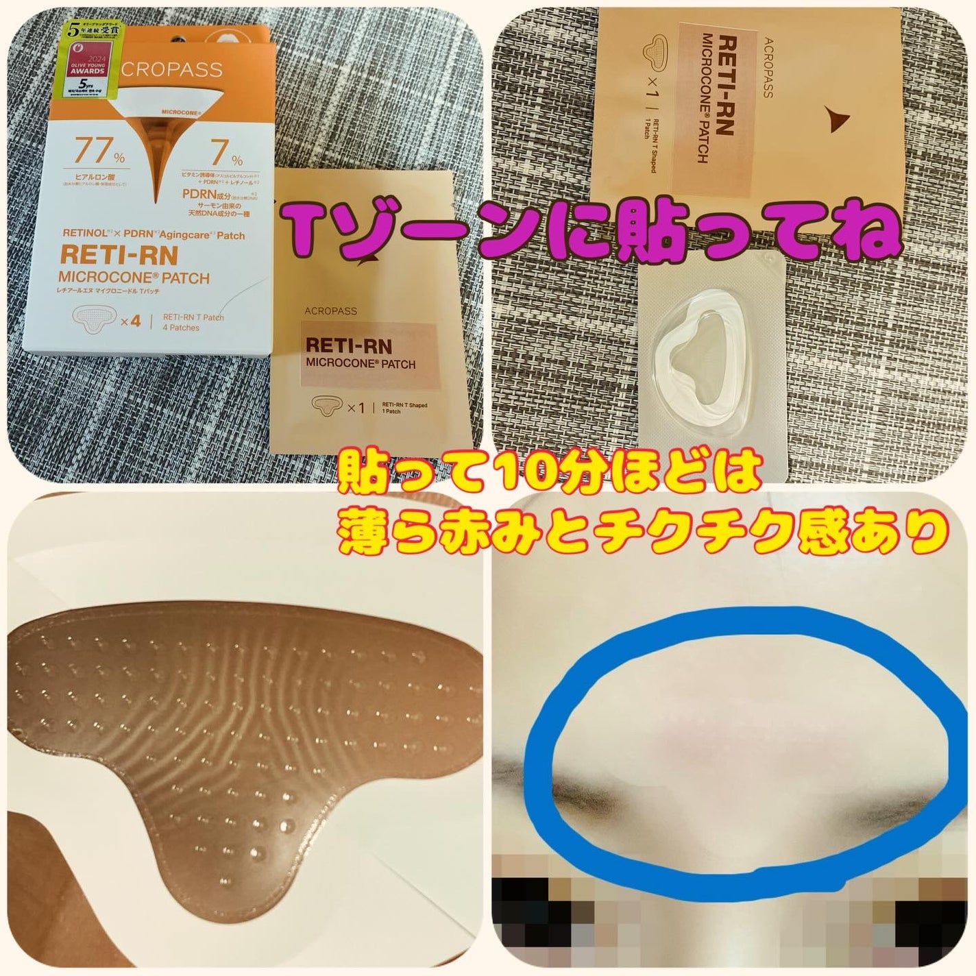 レチアールエヌ スリムパッチ/ACROPASS/シートマスク・パックを使ったクチコミ(2枚目)