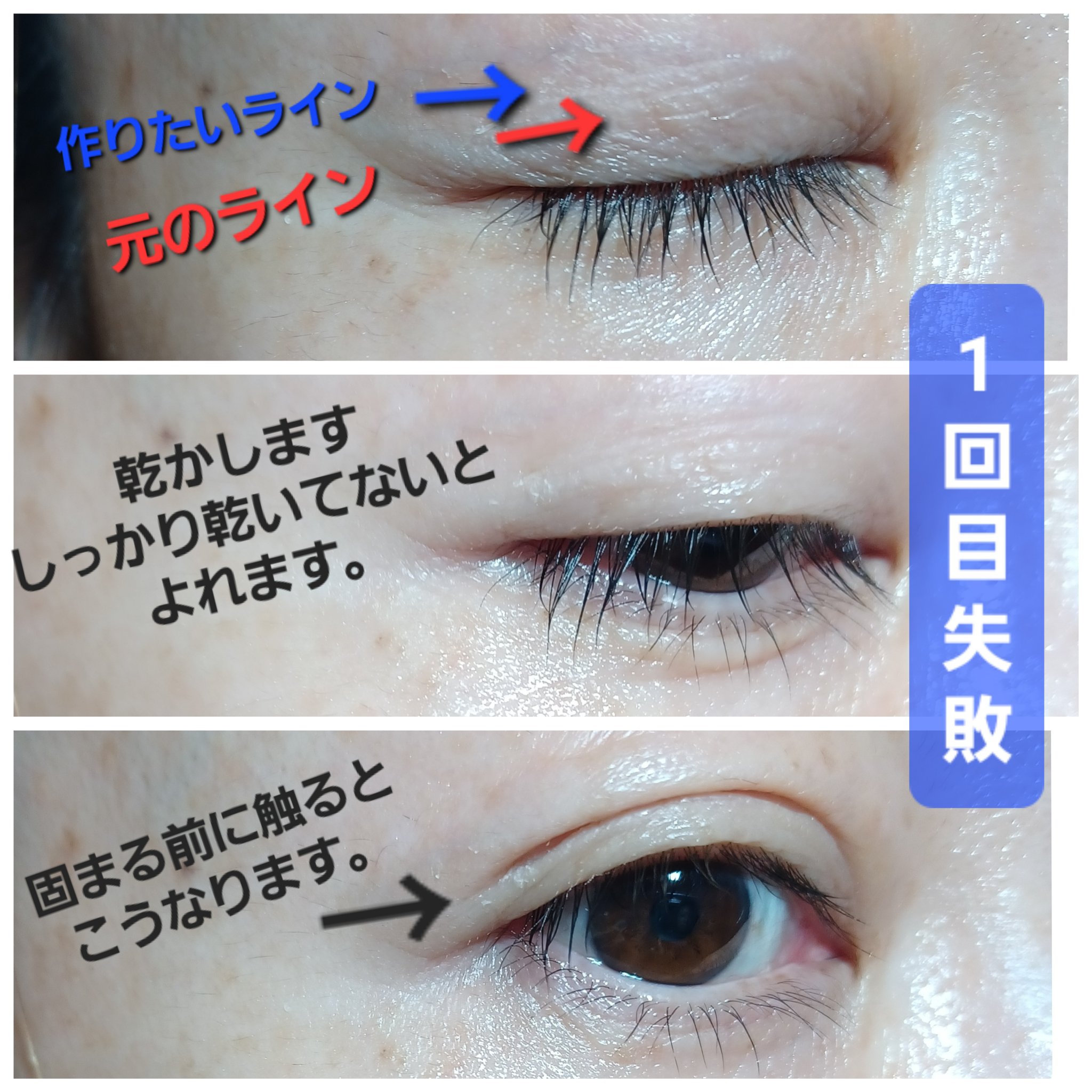 オリシキ アイリッドスキンフィルム EX/D-UP/二重まぶた用アイテムを使ったクチコミ（3枚目）