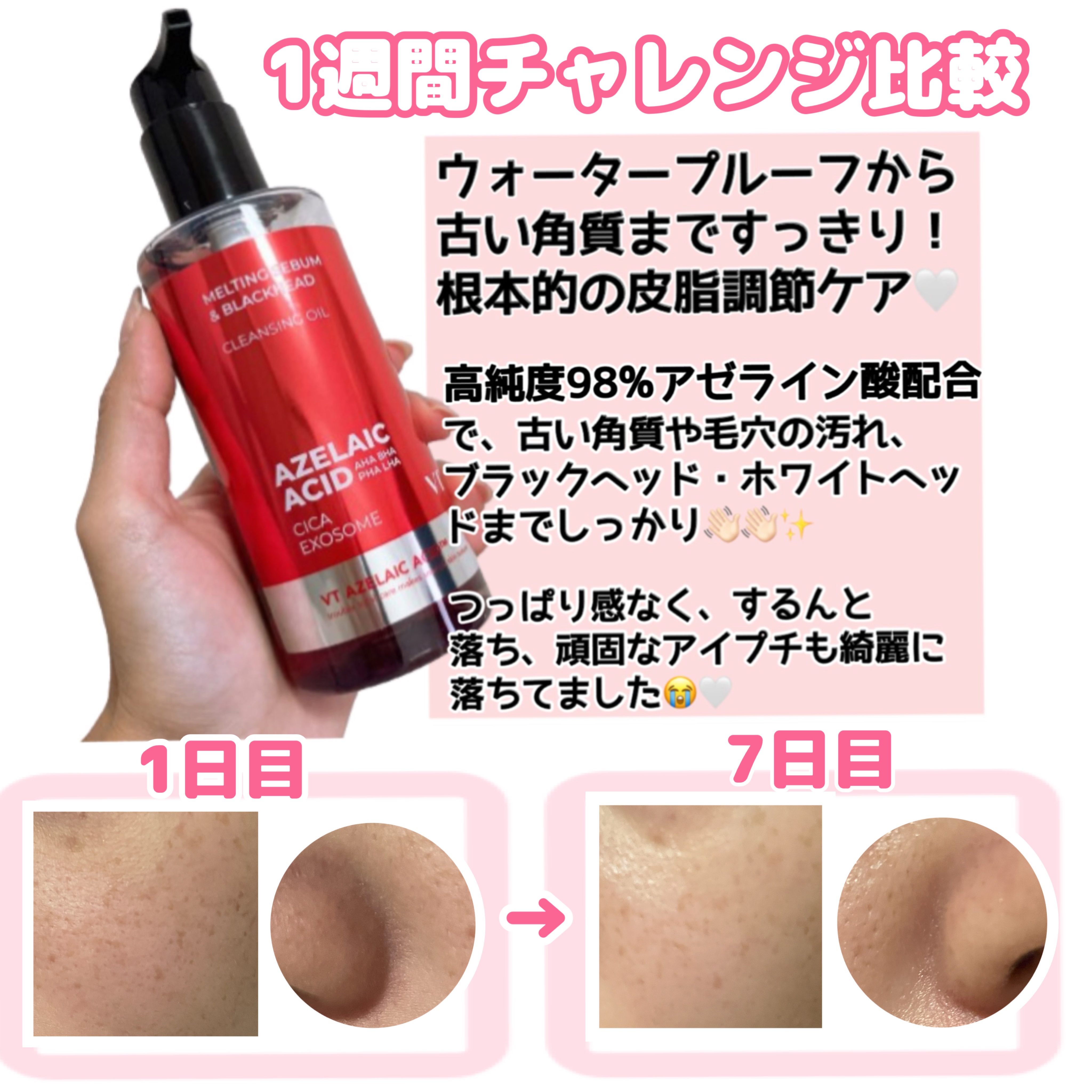 アゼライン酸クレンジングオイル/VT/オイルクレンジングを使ったクチコミ（2枚目）