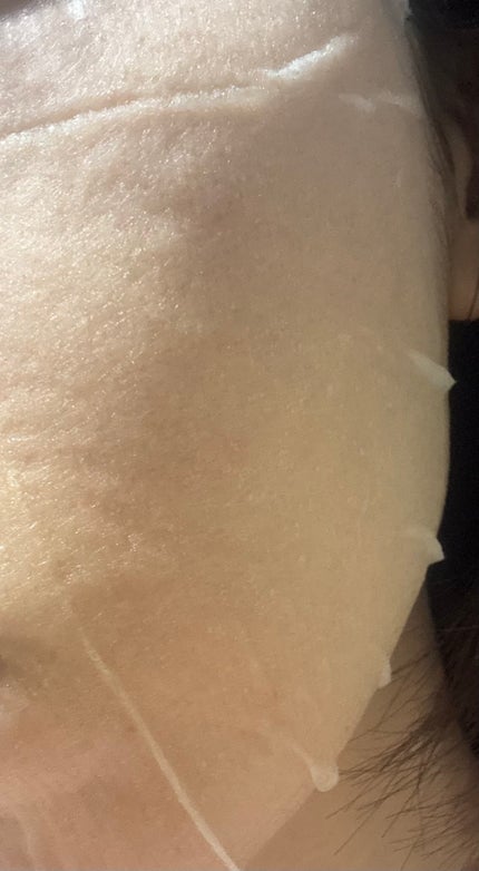 ドクダミシートマスクデイリーピック/Abib /シートマスク・パックを使ったクチコミ(2枚目)