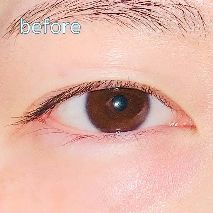 オリシキ アイリッドスキンフィルム EX/D-UP/二重まぶた用アイテムを使ったクチコミ(2枚目)