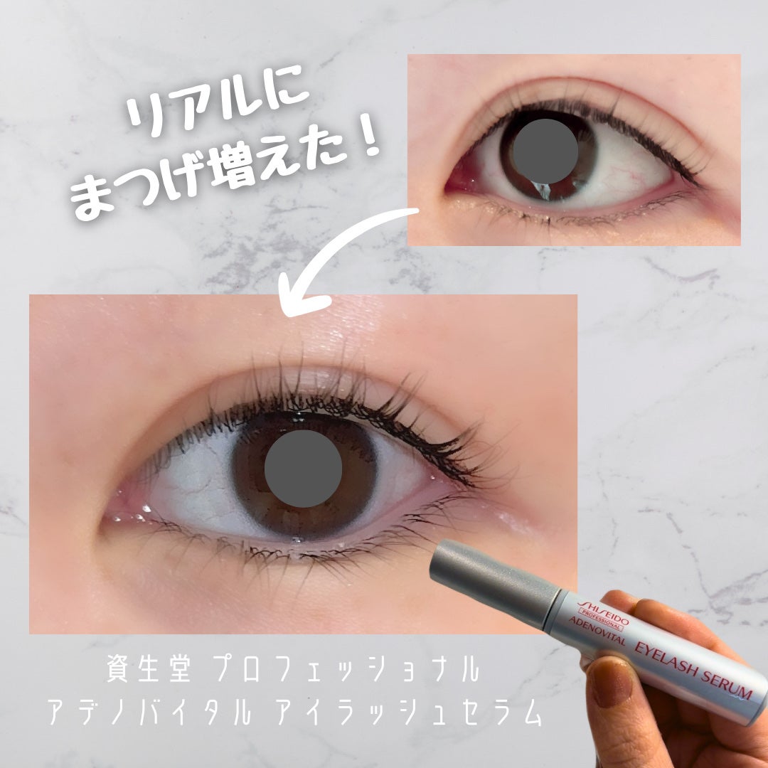 アデノバイタル アイラッシュセラム/資生堂プロフェッショナル/まつげ美容液を使ったクチコミ(1枚目)