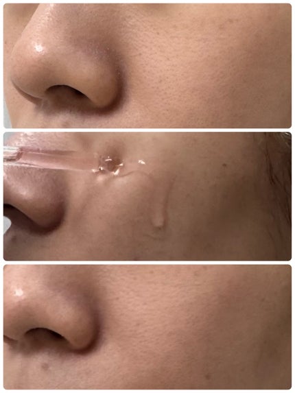 AHA 9.12 オミジャ 陶器肌 ウォッシュオフ セラム/parnell/美容液を使ったクチコミ(6枚目)