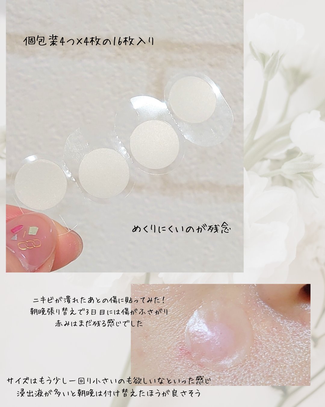 バンドエイド　顔用パッチ/バンドエイド/その他スキンケアを使ったクチコミ（3枚目）