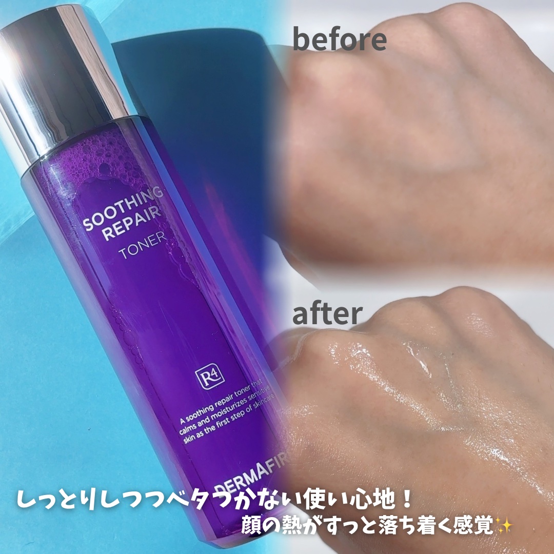 [R4] スージングリペアトナー/ダーマファーム/化粧水を使ったクチコミ（3枚目）