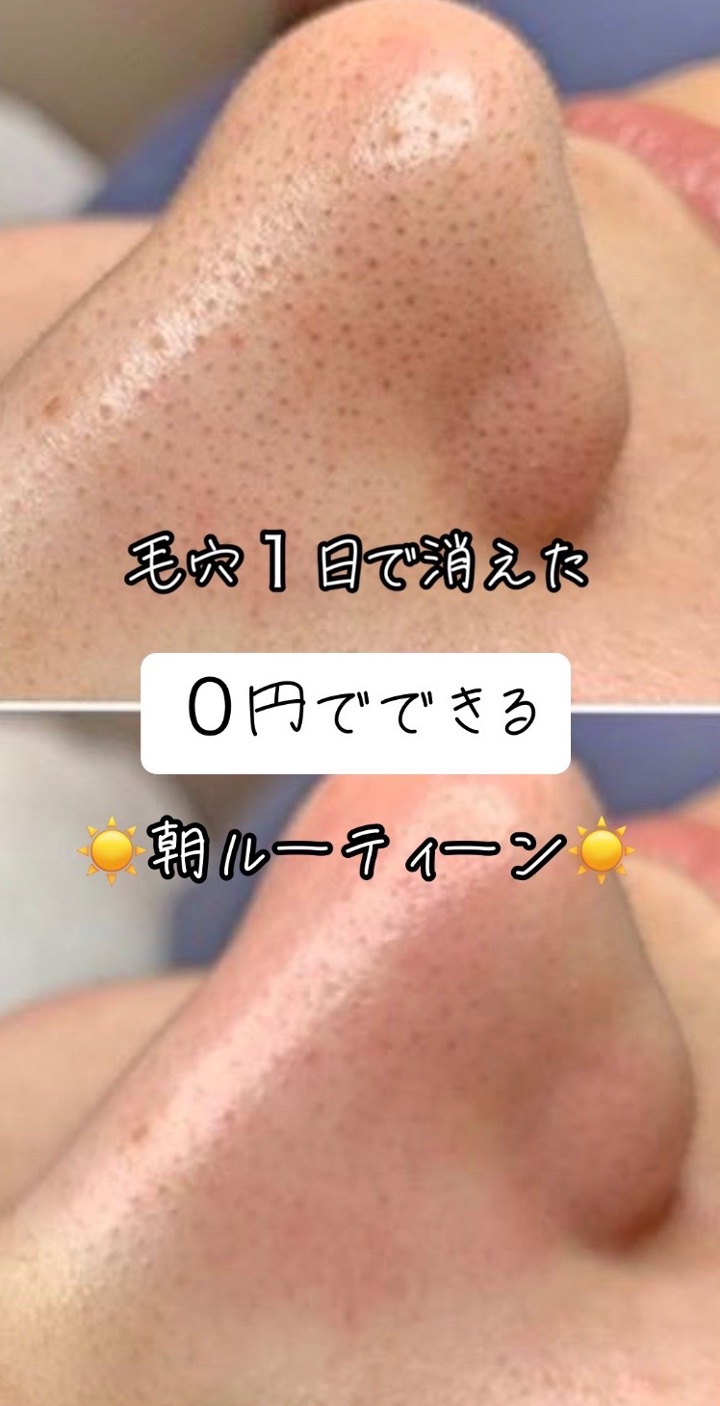 アネトス バランシング トリートメントクリーム/Anetos/フェイスクリームを使ったクチコミ（1枚目）