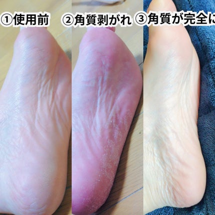 シルキーココナッツオイルフットマスク /MADFORCOS/レッグ・フットケアを使ったクチコミ(3枚目)