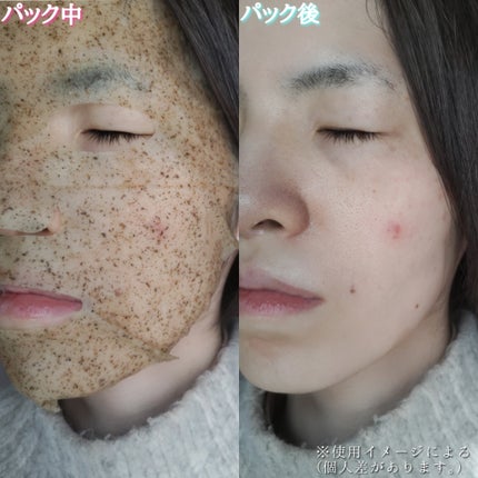 ツボクサスージングハイドロヨモギマスク/LIALUSTER/シートマスク・パックを使ったクチコミ(6枚目)