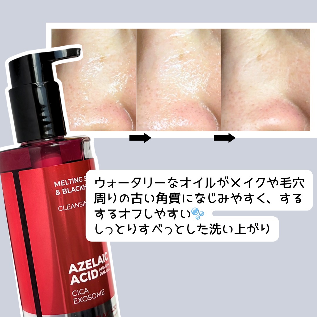 AZケア クレンジングオイル/VT/オイルクレンジングを使ったクチコミ（2枚目）