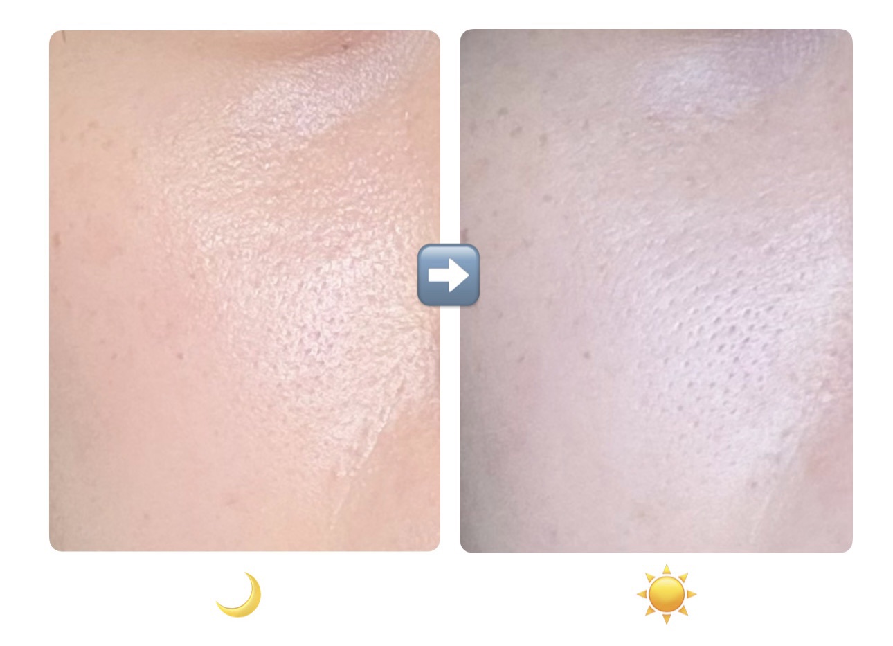 フローリフティングラッピングクリーム/koy/フェイスクリームを使ったクチコミ（3枚目）