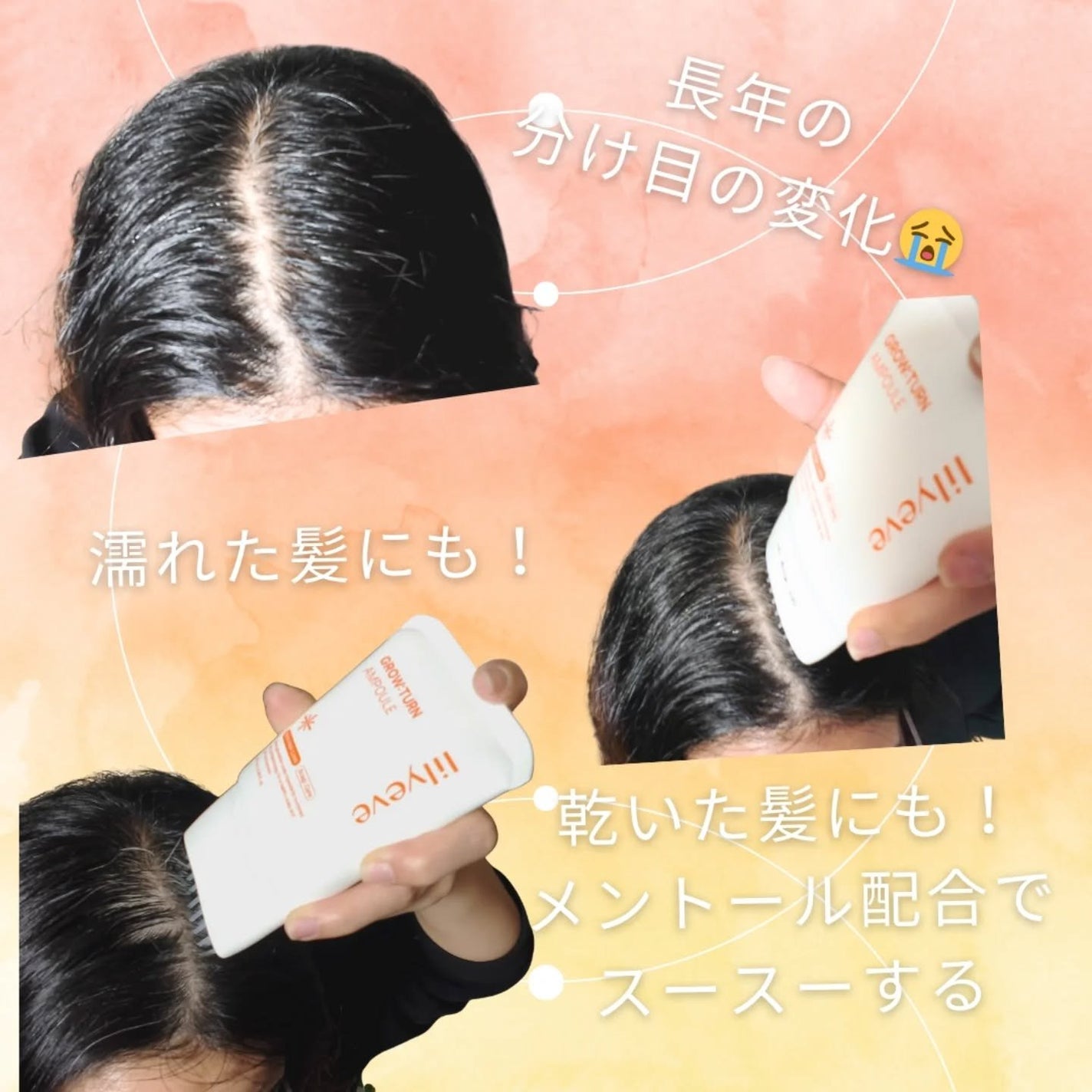 グローターンヘアアンプル/リリーイブ/頭皮ローションを使ったクチコミ(3枚目)