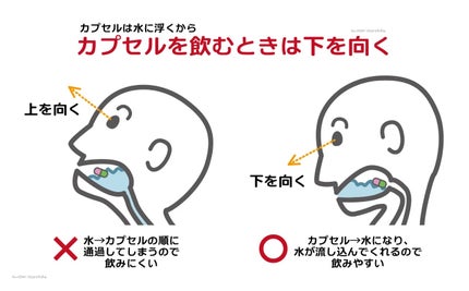 ãã¥ãŒã¹ã¿ãŒ æç¶åãã¿ãã³C1000/matsukiyo LAB/çŸå®¹ãµããªã¡ã³ãã䜿ã£ãã¯ãã³ãïŒ3æç®ïŒ