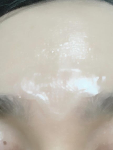 レチアールエヌ スリムパッチ/ACROPASS/シートマスク・パックを使ったクチコミ(8枚目)