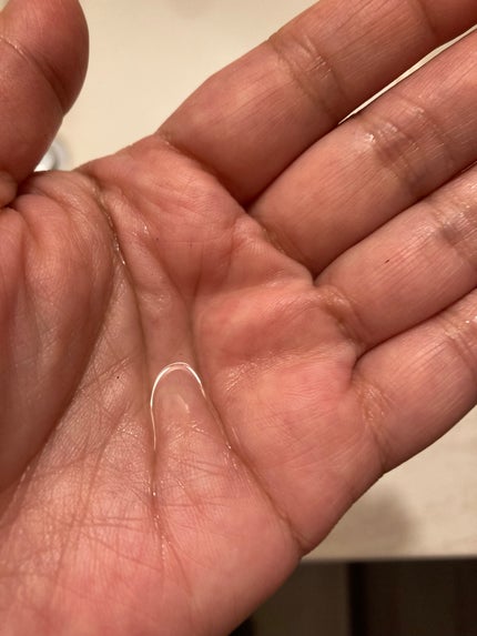 インジェスク NM 10000 デュオ ドリップ セラム/INJESK/美容液を使ったクチコミ(5枚目)