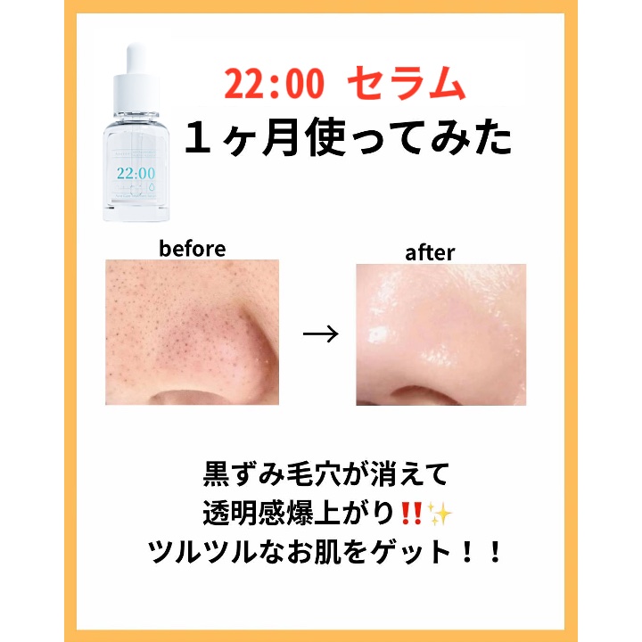 アネトス アクネケア トリートメント セラム/Anetos/美容液を使ったクチコミ（2枚目）