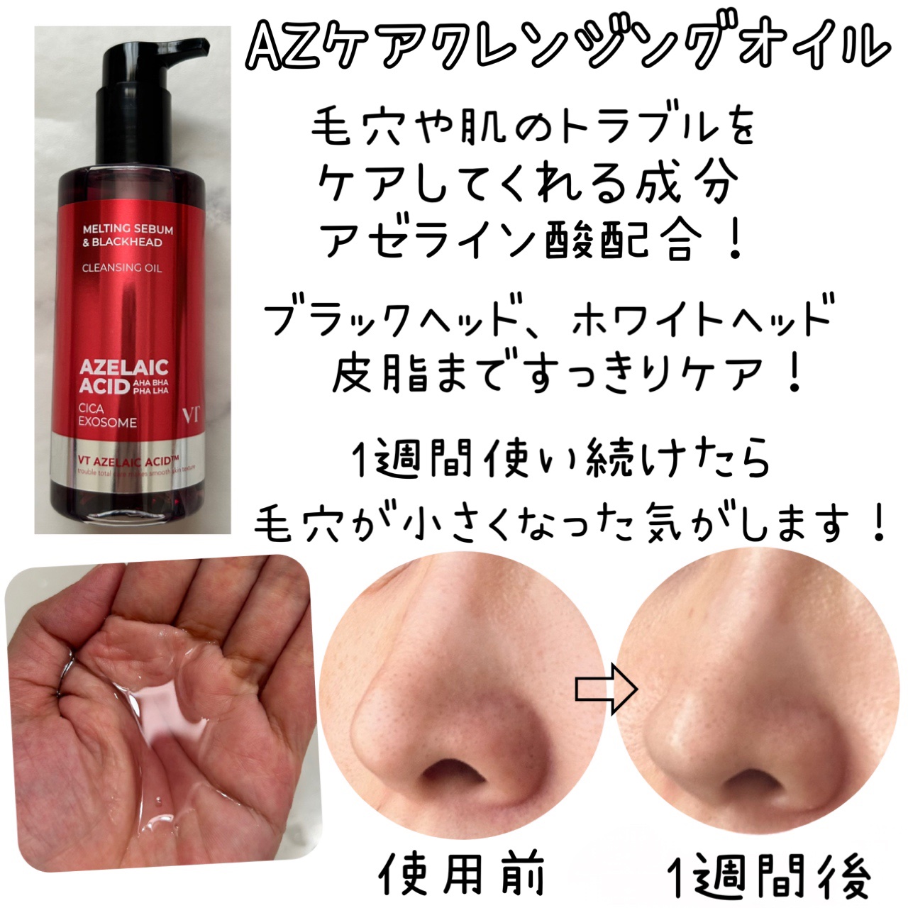 AZケア クレンジングオイル/VT/オイルクレンジングを使ったクチコミ（3枚目）