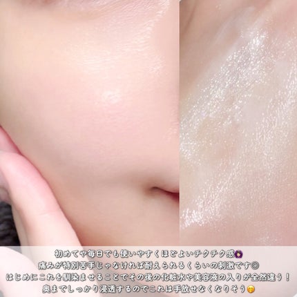 リードルショット100/VT/美容液を使ったクチコミ(3枚目)