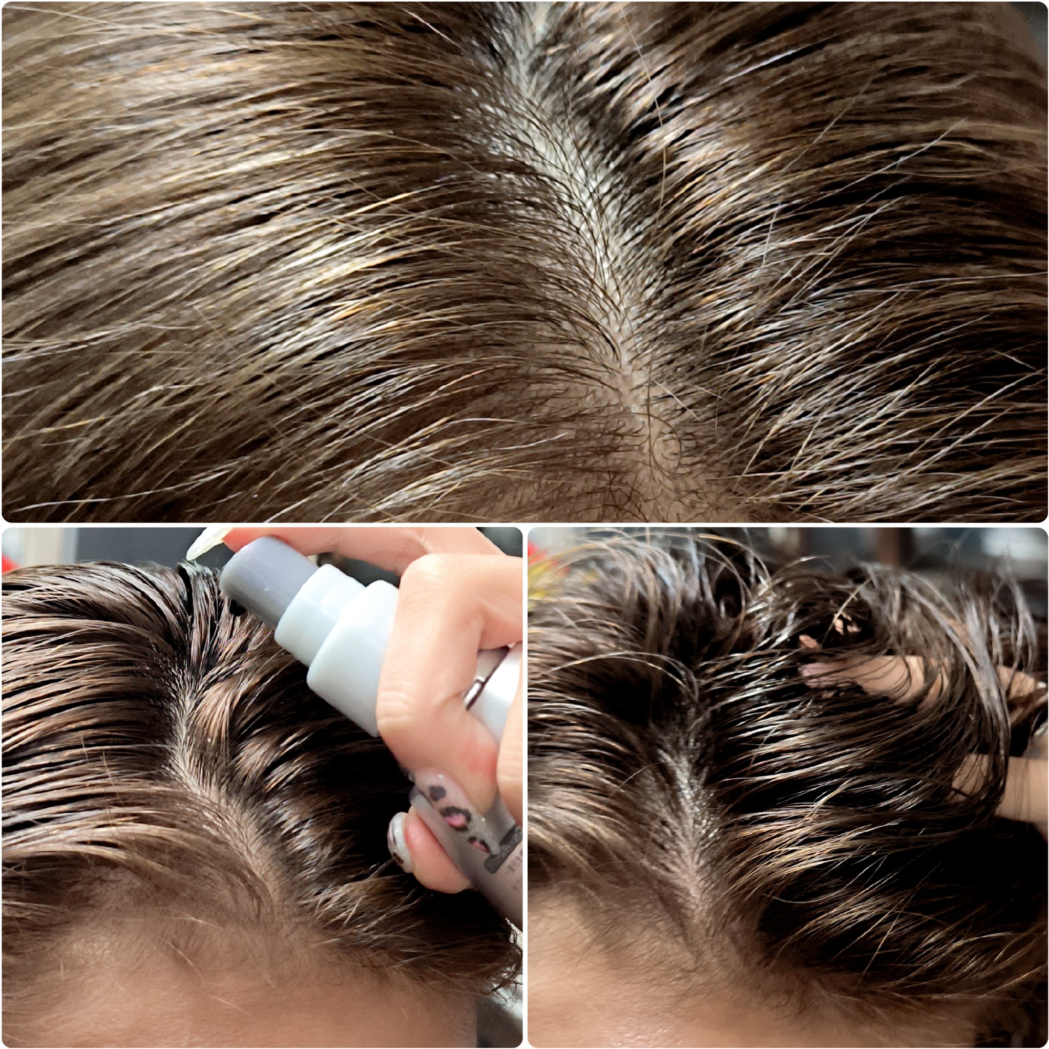 アデノバイタル スカルプ パワーショット/サブリミック/頭皮ローションを使ったクチコミ（3枚目）