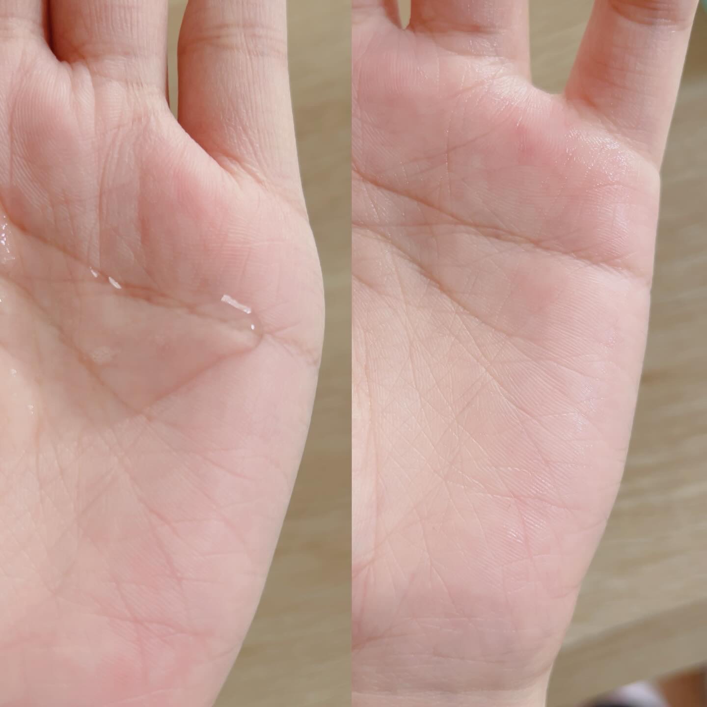 リラックス シカ アクア トナー/LAIEL/化粧水を使ったクチコミ（2枚目）