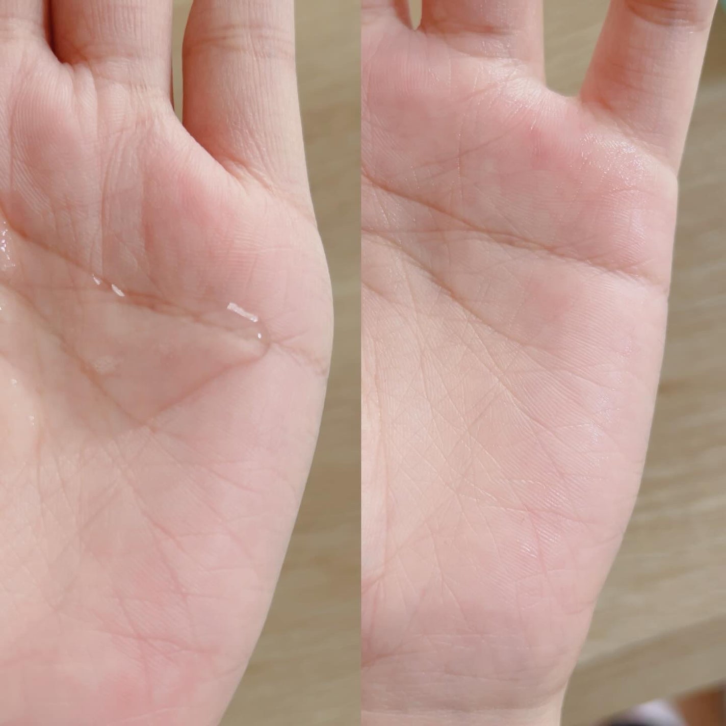 リラックス シカ アクア トナー/LAIEL/化粧水を使ったクチコミ(2枚目)