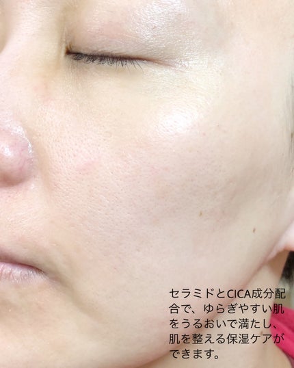 リラックス シカ アクア トナー/LAIEL/化粧水を使ったクチコミ(4枚目)